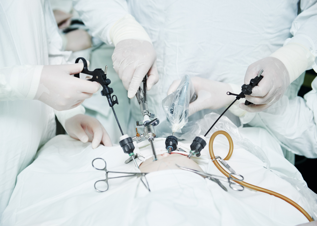 Laparoscopic Surgery